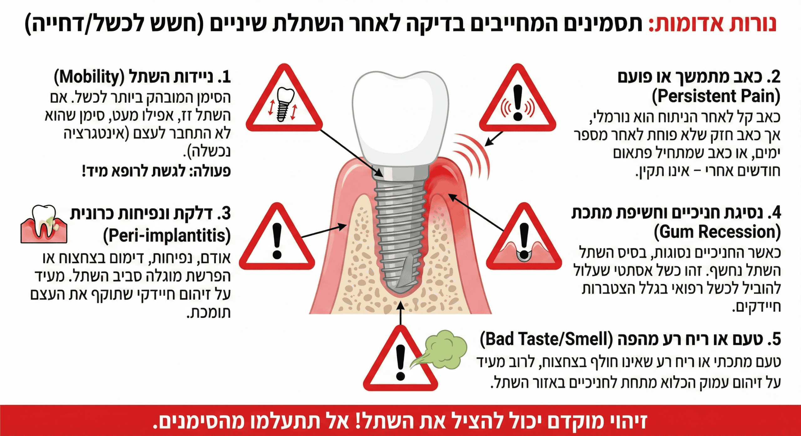 לוקס דנטל גרופ | אילו תסמינים מעידים על דחיית שתל שיניים? סימנים המתריעים על דחיית שתל שיניים