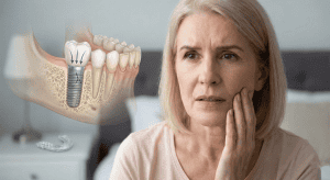 לוקס דנטל גרופ | כיצד שחיקת שיניים (ברוקסיזם) יכולה לשבור שתל עמיד מטיטניום כיצד ברוקסיזם עלול לפגוע בשתל טיטניום עמיד?